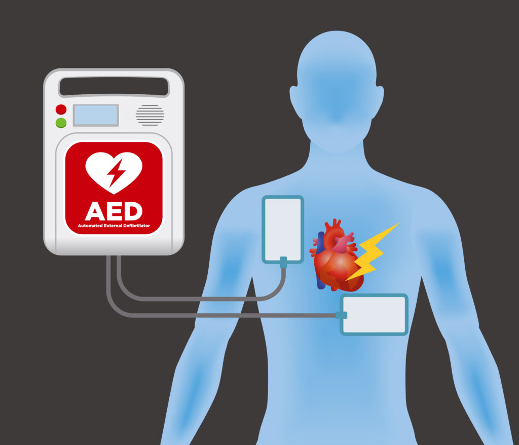 EMC CPR Training How To Purchase An AED